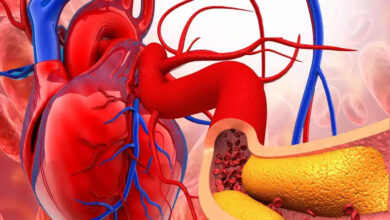 Tips to Control Cholesterol: कोलेस्ट्रॉल बढ़ने से बढ़ सकता है दिल की बीमारियों का खतरा