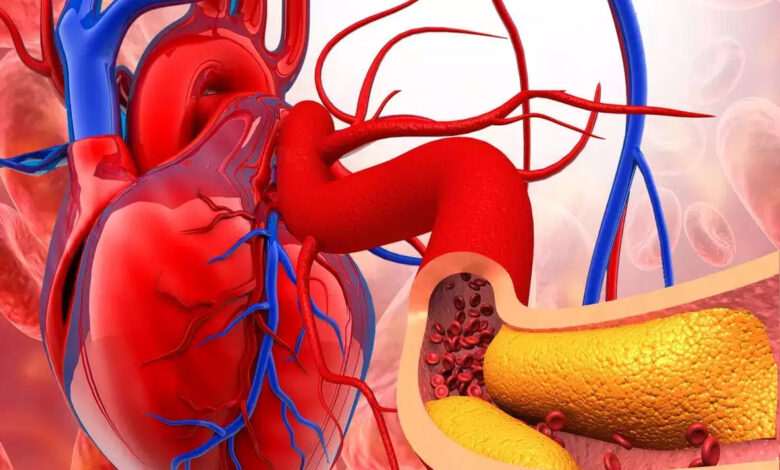 Tips to Control Cholesterol: कोलेस्ट्रॉल बढ़ने से बढ़ सकता है दिल की बीमारियों का खतरा